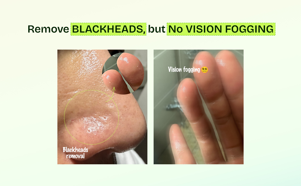 Orien Mugwort Zero Film Temizleme Yağı (200 ml) - Görsel 6